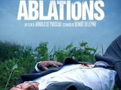 Critique Ciné Ablations, feriez vous volait rein