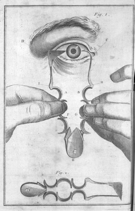 L'œil, la goutte et le glaucome, une histoire tirée de faits réels. L'œil, la goutte et le glaucome, une histoire tirée de faits réels.